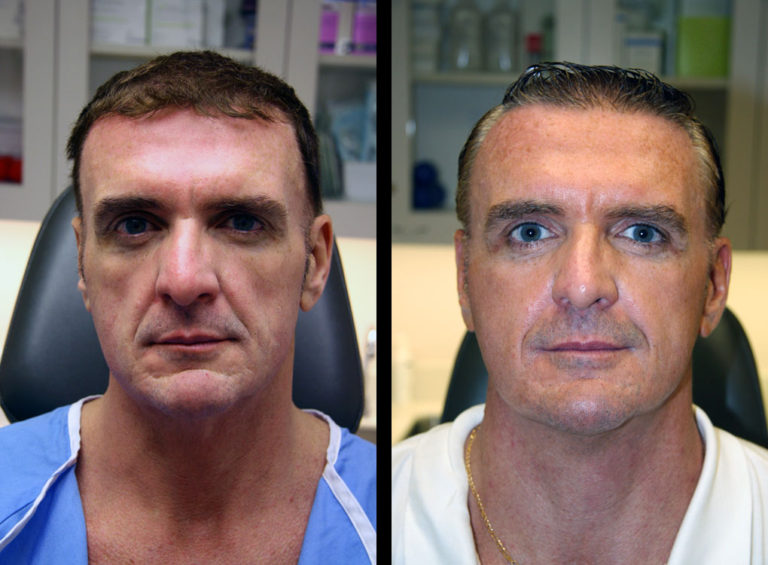 Adult Stem Cell Therapy ARTScienceDNA